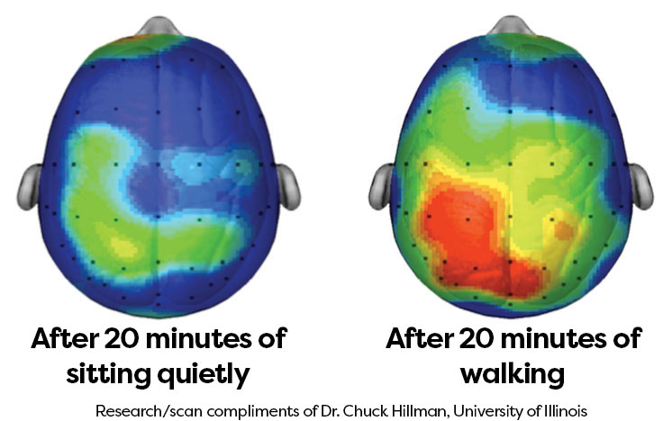 Brain scan images after sitting quietly for 20 minutes and after 20 minutes of walking